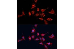 Immunofluorescence analysis of C6 cells using  antibody (ABIN7265433) at dilution of 1:100. (ADAM11 Antikörper  (AA 290-430))