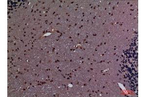 Immunohistochemistry (IHC) analysis of paraffin-embedded Rat Brain, antibody was diluted at 1:100.