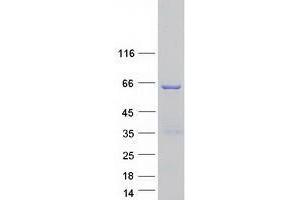 TSEN54 Protein (Myc-DYKDDDDK Tag)