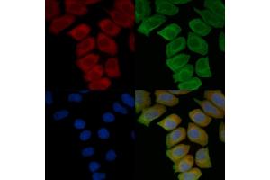 ABIN7096825 and ABIN7100891 staining Hela cells(45 min of heat-shock treatment) by IF/ICC.