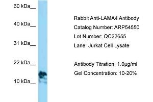 Western Blotting (WB) image for anti-Laminin, alpha 4 (LAMa4) (C-Term) antibody (ABIN2785768) (LAMa4 Antikörper  (C-Term))