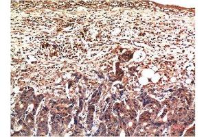 Immunohistochemistry (IHC) image for anti-Ubiquitin (Ub) antibody (ABIN7193134)