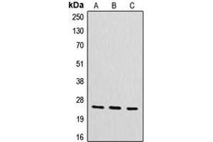Western blot analysis of CYB561D2 expression in HeLa (A), mouse liver (B), rat kidney (C) whole cell lysates. (CYB561D2 Antikörper  (Center))
