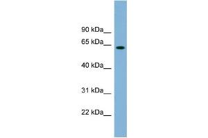 WB Suggested Anti-SLFN12 Antibody Titration: 0. (SLFN12 Antikörper  (Middle Region))