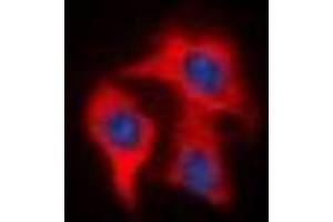 Immunofluorescent analysis of FAP alpha staining in HeLa cells. (FAP Antikörper)