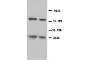 Western blot analysis of rat thymus tissue lysis using NIP3 antibody (BNIP3 Antikörper  (C-Term))