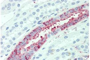 Anti-SLC4A2 antibody  ABIN1049340 IHC staining of human kidney.