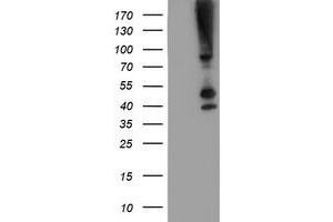 Western Blotting (WB) image for anti-serpin Peptidase Inhibitor, Clade B (Ovalbumin), Member 13 (SERPINB13) antibody (ABIN1500878)