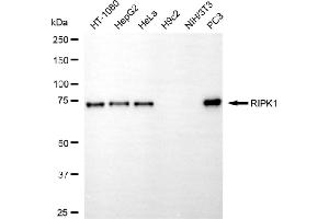 Western blotting analysis using RIPK1 antibody (ABIN7800152).
