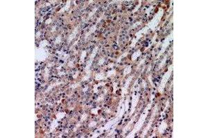 Immunohistochemical analysis of Tensin 3 staining in human kindey formalin fixed paraffin embedded tissue section. (TNS3 Antikörper)