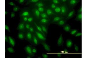 Immunofluorescence of monoclonal antibody to STK4 on HeLa cell.