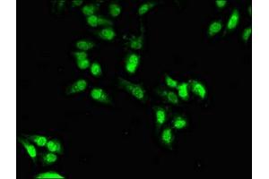 Immunofluorescent analysis of Hela cells using ABIN7155835 at dilution of 1:100 and Alexa Fluor 488-congugated AffiniPure Goat Anti-Rabbit IgG(H+L) (OTX1 Antikörper  (AA 29-244))