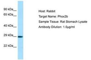 Image no. 1 for anti-Paired-Like Homeobox 2b (PHOX2B) (N-Term) antibody (ABIN6749847)