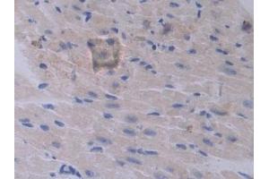 Immunohistochemistry (IHC) image for anti-Proprotein Convertase Subtilisin/kexin Type 1 (PCSK1) (AA 244-530) antibody (ABIN7443446)