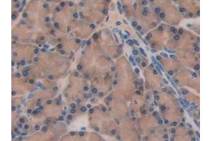 Immunohistochemistry (IHC) image for anti-Natural Killer Cell Receptor 2B4 (CD244) (AA 20-221) antibody (ABIN7441829)