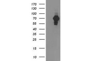 Western Blotting (WB) image for anti-SH2B Adaptor Protein 3 (SH2B3) antibody (ABIN1500908)