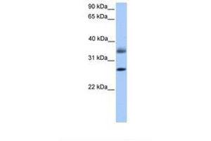 Image no. 1 for anti-Lectin, Galactoside-Binding, Soluble, 8 (LGALS8) (C-Term) antibody (ABIN6738874)