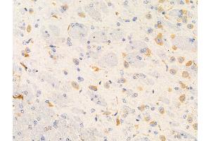 ABIN6261878 and ABIN6266545 at 1/100 staining Mouse brain tissue by IHC-P. (GANP Antikörper  (C-Term))