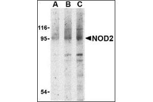 Western blot analysis of NOD2 in Jurkat cell lysate with this product at (A) 1, (B) 2 and (C) 4 μg/ml.