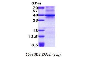SDS-PAGE (SDS) image for Cyclin-Dependent Kinase 3 (CDK3) (AA 1-305) protein (His tag) (ABIN5853044) (CDK3 Protein (AA 1-305) (His tag))