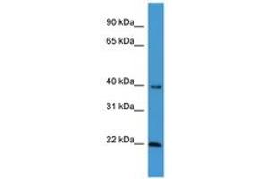 Image no. 1 for anti-Estrogen Receptor Binding Site Associated, Antigen, 9 (EBAG9) (C-Term) antibody (ABIN6746697) (RCAS1 Antikörper  (C-Term))