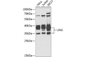 Western blot analysis of extracts of various cell lines, using UNG antibody (ABIN6133476, ABIN6149934, ABIN6149936 and ABIN6216305) at 1:1000 dilution. (UNG Antikörper  (AA 1-313))