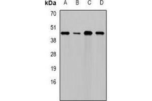 Western blot analysis of DAP expression in HepG2 (A), Hela (B), NIH3T3 (C), rat testis (D) whole cell lysates. (DAP Antikörper)