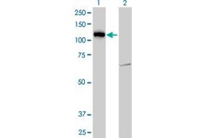 Western Blot analysis of LLGL2 expression in transfected 293T cell line by LLGL2 monoclonal antibody (M06), clone 4G2. (LLGL2 Antikörper  (AA 101-199))