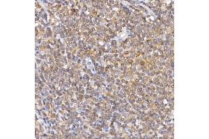 Immunohistochemistry of paraffin-embedded human tonsil using NF Rabbit pAb (ABIN3017384, ABIN3017385, ABIN3017386 and ABIN6220063) at dilution of 1:100 (40x lens).