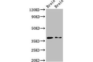 Western Blot Positive WB detected in: Rat brain tissue, Mouse brain tissue All lanes: PEX10 antibody at 2. (PEX1 Antikörper  (AA 63-157))