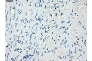 Immunohistochemical staining of paraffin-embedded Ovary tissue using anti-PRKAR1Amouse monoclonal antibody.