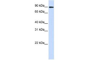 DLG3 antibody used at 1 ug/ml to detect target protein. (DLG3 Antikörper)