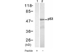 Image no. 1 for anti-Tumor Protein P53 (TP53) (Ser9) antibody (ABIN319302) (p53 Antikörper  (Ser9))