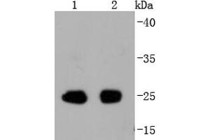 Lane 1: Mouse spleen, Lane 2: Rat spleen cell lysate probed with eIF4E(S209) (2B1) Monoclonal Antibody  at 1:1000 overnight at 4˚C. (EIF4E Antikörper  (pSer209))