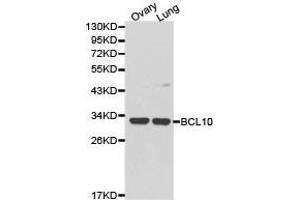 Western Blotting (WB) image for anti-B-Cell CLL/lymphoma 10 (BCL10) antibody (ABIN1871246) (BCL10 Antikörper)