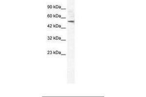 Image no. 2 for anti-Sphingomyelin phosphodiesterase, Acid-Like 3B (SMPDL3B) (AA 88-137) antibody (ABIN6735957) (SMPDL3B Antikörper  (AA 88-137))