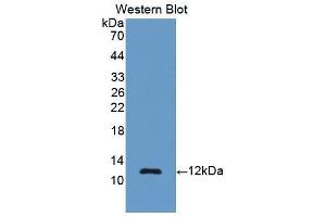 Western blot analysis of the recombinant protein. (Renin Antikörper  (AA 144-237))