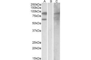 HEK293 lysate (10ug protein in RIPA buffer) overexpressing Human RACGAP1 with DYKDDDDK tag probed with ABIN2564849 (0. (RACGAP1 Antikörper  (C-Term))