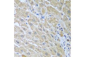 Immunohistochemistry of paraffin-embedded human liver using WDR48 antibody (ABIN5974731) at dilution of 1/100 (40x lens). (WDR48 Antikörper)