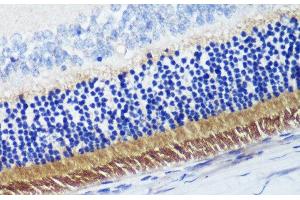 Immunohistochemistry of paraffin-embedded Rat retina using PDE6B Polyclonal Antibody at dilution of 1:200 (40x lens).
