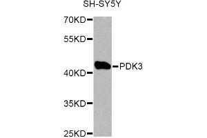 Western blot analysis of extracts of SH-SY5Y cells, using PDK3 Antibody. (PDK3 Antikörper)