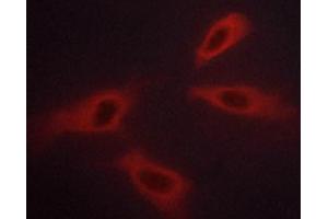 ABIN6267254 staining K562 cells by ICC/IF.