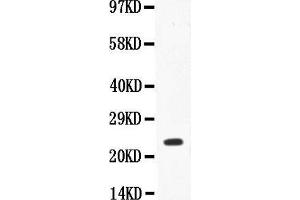 Anti-IL18 Picoband antibody,  All lanes: Anti-IL18 at 0. (IL-18 Antikörper  (AA 37-193))