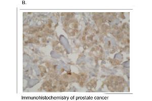 Immunohistochemistry (IHC) image for anti-Cytochrome P450, Family 3, Subfamily A, Polypeptide 7 (CYP3A7) (C-Term) antibody (ABIN307113)