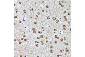 Immunohistochemistry (IHC) image for anti-Heterogeneous Nuclear Ribonucleoprotein L (HNRNPL) (AA 282-589) antibody (ABIN6141915)