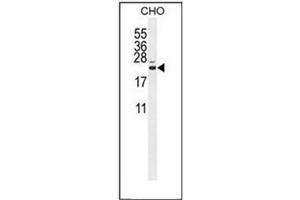 Western blot analysis of CP013 Antibody (N-term) in CHO cell line lysates (35ug/lane).