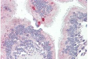 Anti-AP3M1 antibody IHC staining of human lung, respiratory epithelium. (AP3M1 Antikörper  (AA 140-190))