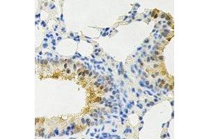 Immunohistochemical analysis of PPX staining in rat lung formalin fixed paraffin embedded tissue section. (PPP4C Antikörper)