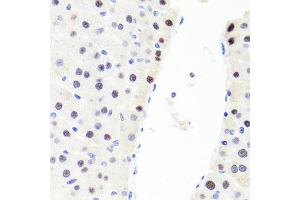 Immunohistochemistry of paraffin-embedded rat liver using RUNX1 antibody (ABIN6291786) at dilution of 1:100 (40x lens). (RUNX1 Antikörper)