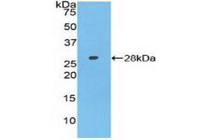 Detection of Recombinant AXIN, Human using Polyclonal Antibody to Axis Inhibition Protein (AXIN) (Axin Antikörper  (AA 653-862))